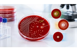 blood agar