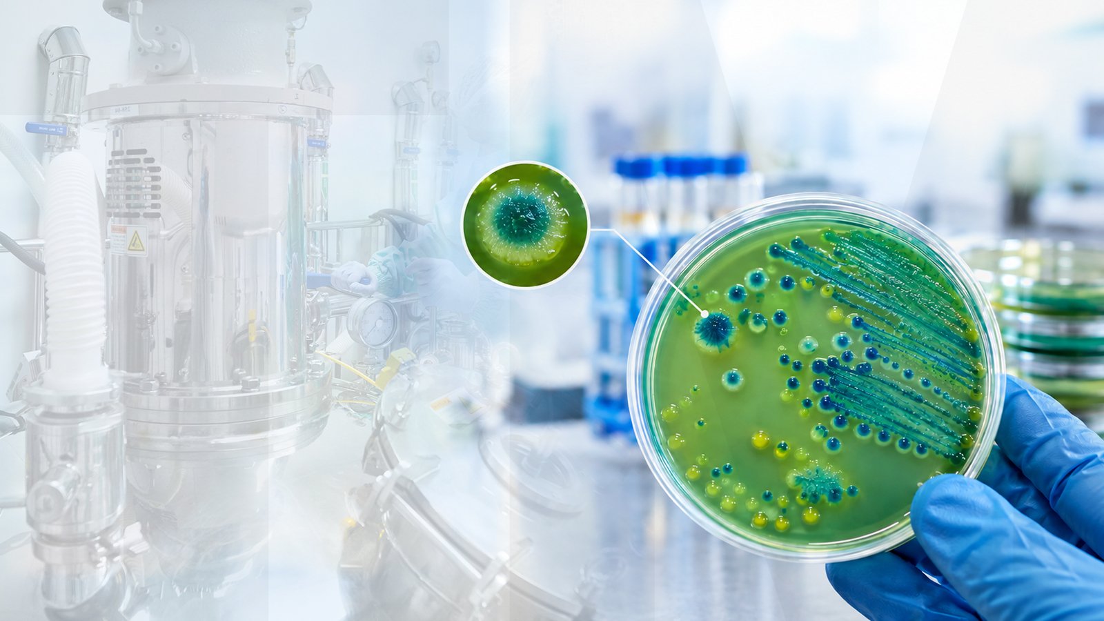 Cetrimide Agar: When Selective Growth Becomes a Microbial Clue